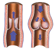 Venensystem